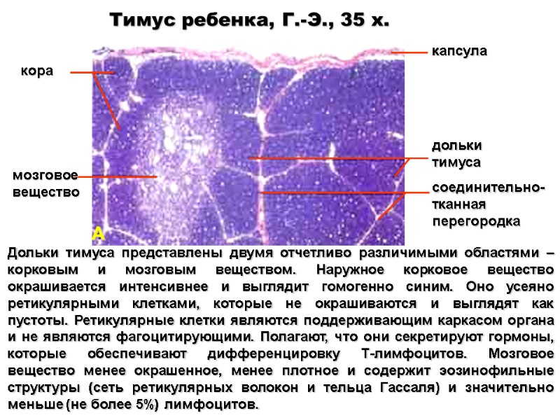 Тимус ребенка, Г.-Э., 35 x. Дольки тимуса представлены двумя отчетливо различимыми областями – корковым
